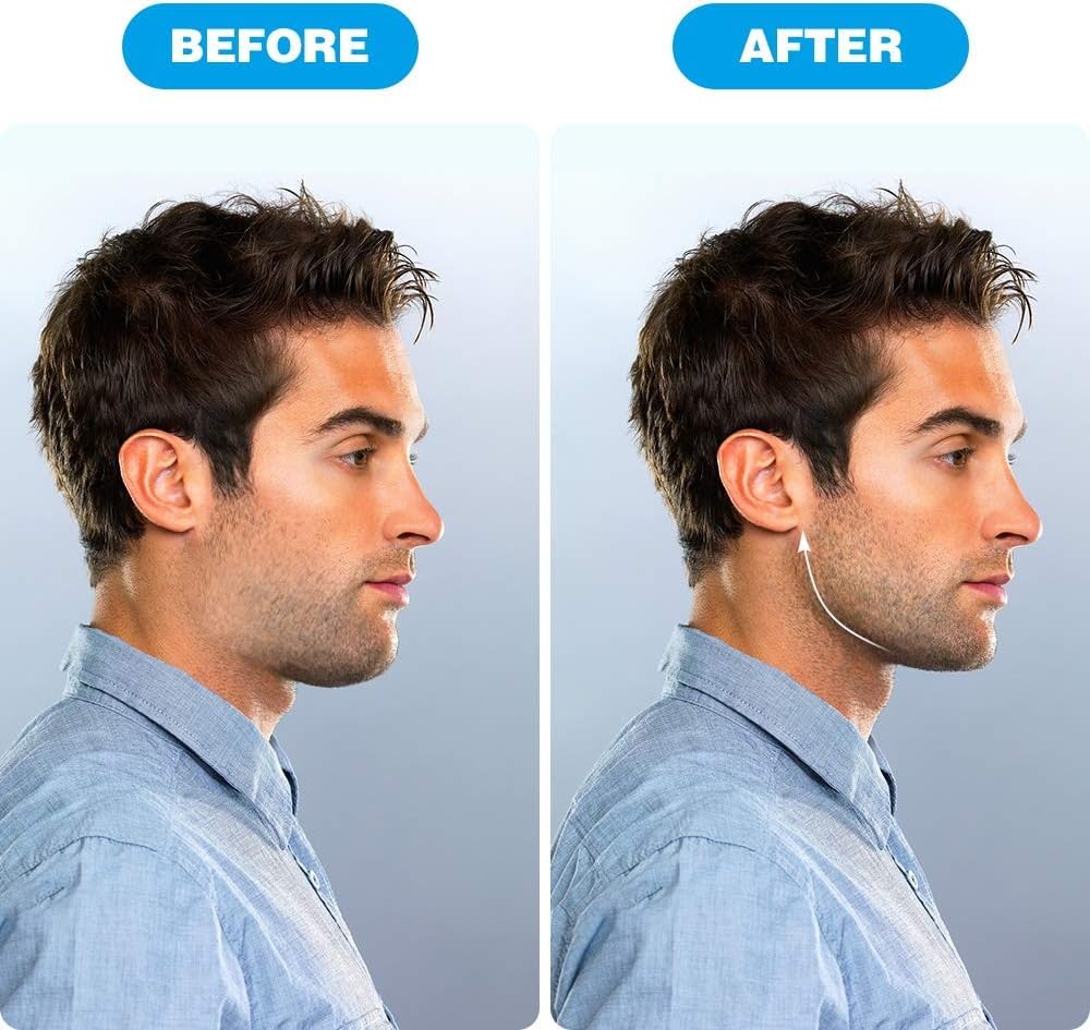 JawFlex™ Advanced Jaw Trainer