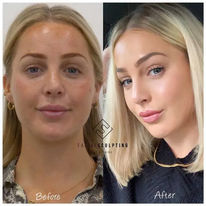 JawTone™ Advanced Jaw Exerciser (SALE LIVE 🔥🔥)